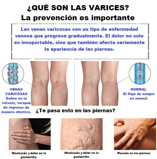 Medias Médicas graduadas para circulación (Sin puntera)